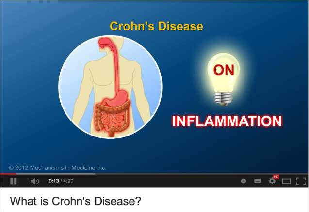 Entendiendo la colitis ulcerosa y la enfermedad de Crohn